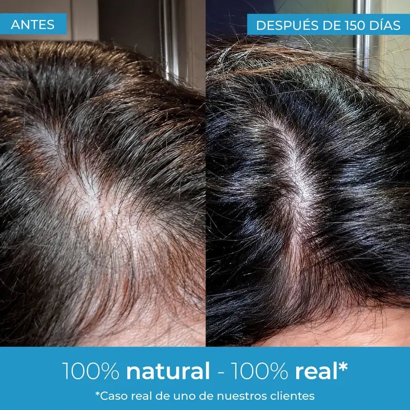 Arganour Hair Strength Hair Growth Lotion, 50 Ml