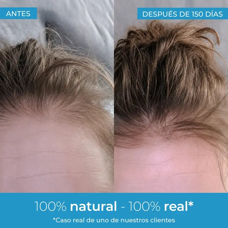 Arganour Hair Strength Hair Growth Lotion, 50 Ml
