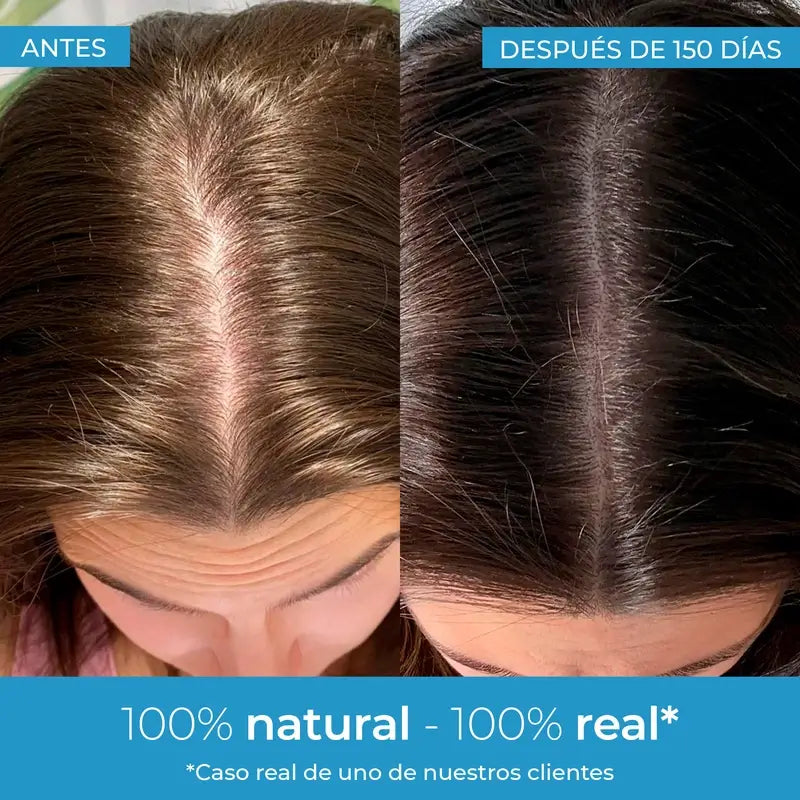 Arganour Hair Strength Hair Growth Lotion, 50 Ml