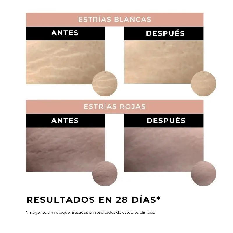 Arganour Crème Vergetures Corps, 100 Ml