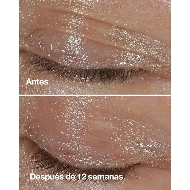 Clinique Smart Clinical Repair Crème anti-rides pour les yeux, 3x15 ml