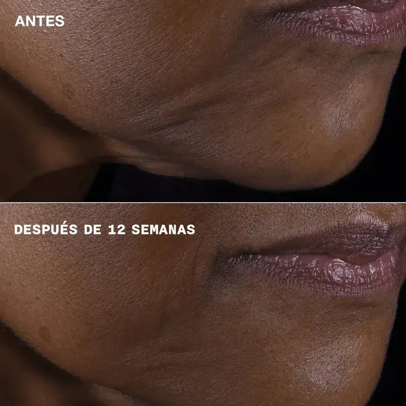 Clinique Smart Clinical Repair Anti-Aging Face and Neck, 50 ml