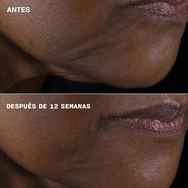 Clinique Smart Clinical Repair Firming + Lifting pour le visage et le cou, 75 ml