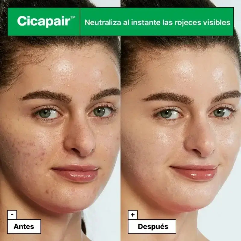 Dr. Jart+ Cicapair Tiger Grass Redness Colour Treatment, 30 ml
