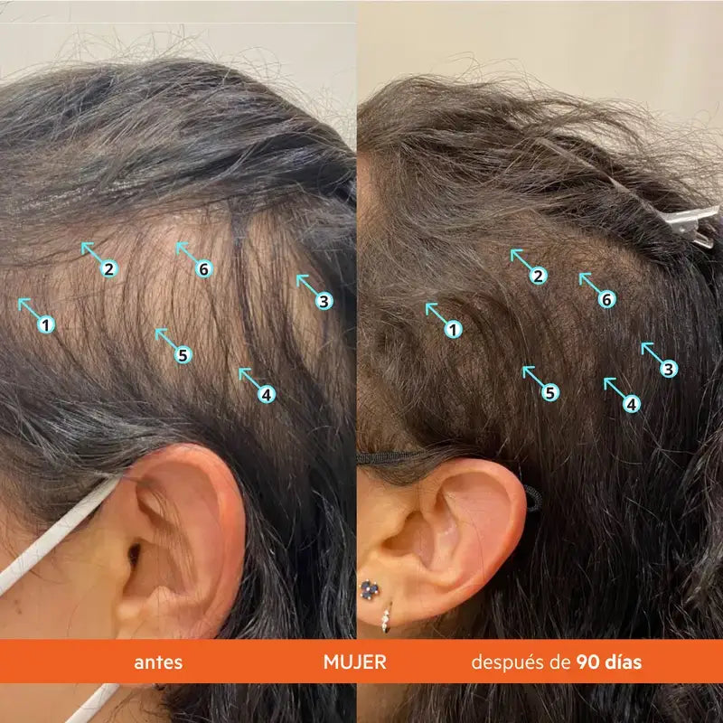 Ds Laboratories Revita Anti-Hair Loss Stimulating Hair Conditioner, 925 ml