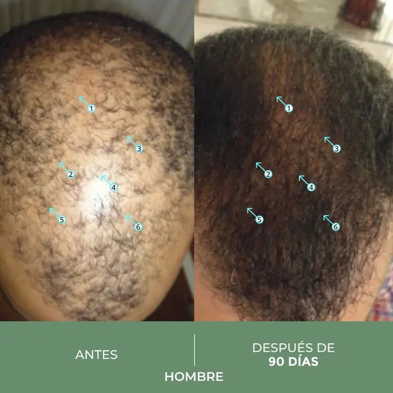 Ds Laboratories Spectral Cbd Hair Loss Lotion, 60 ml