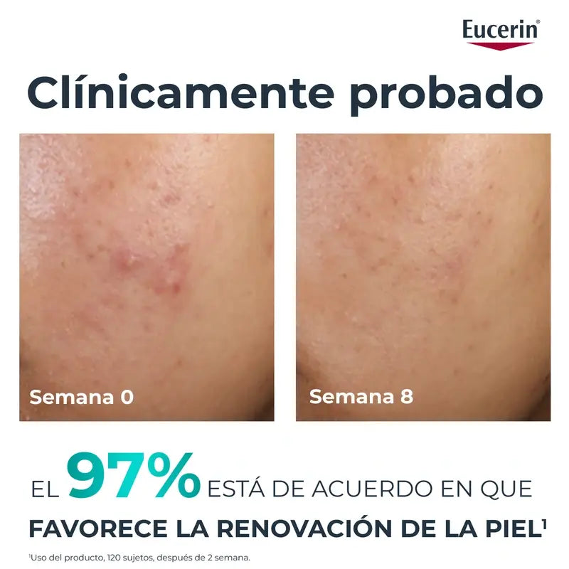 Eucerin Dermopure Peeling 10% Acides Hydroxylés, 40 ml