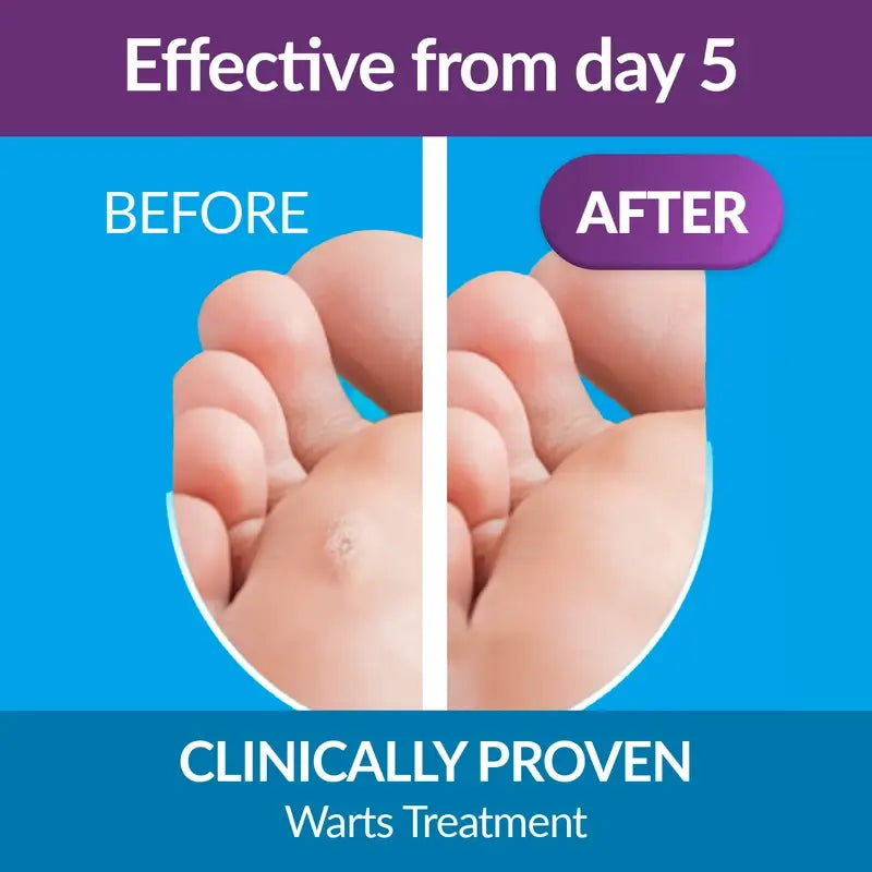 Excilor Pen Traitement des mycoses de l'ongle, 3,3 ml