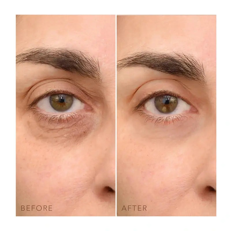 Foreo Iris™ Crème pour les yeux 15 Ml