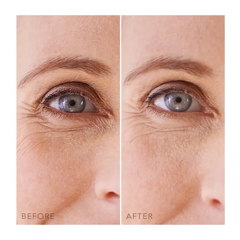 Foreo Iris™ Patchs sous les yeux 60 Pcs