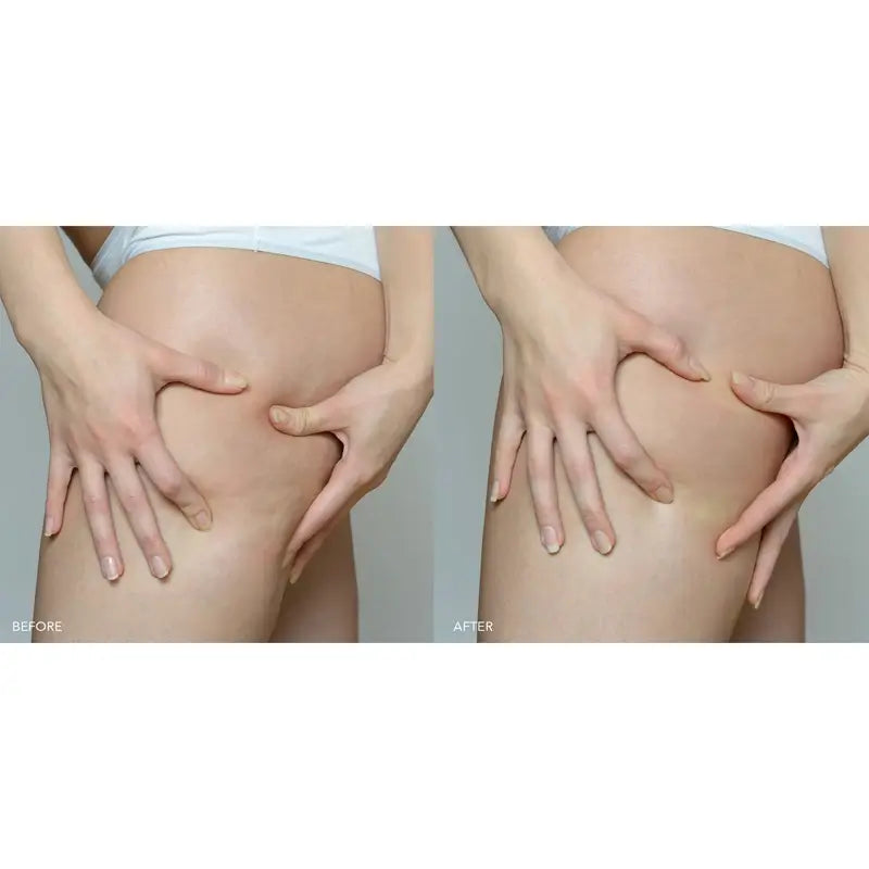 Foreo Supercharged™ Firming Body Serum (sérum corporel raffermissant)