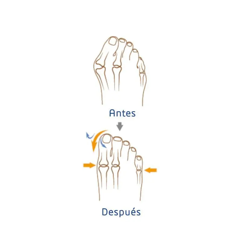 Garcia 1880 Correcteur d'Hallux Valgus Taille droite L/Xl
