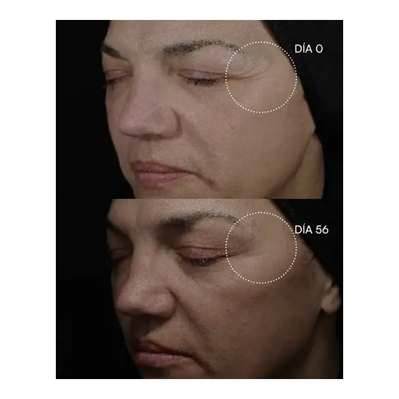 Gema Herrerías 20 Peeling chimique 20 disques 23 ml