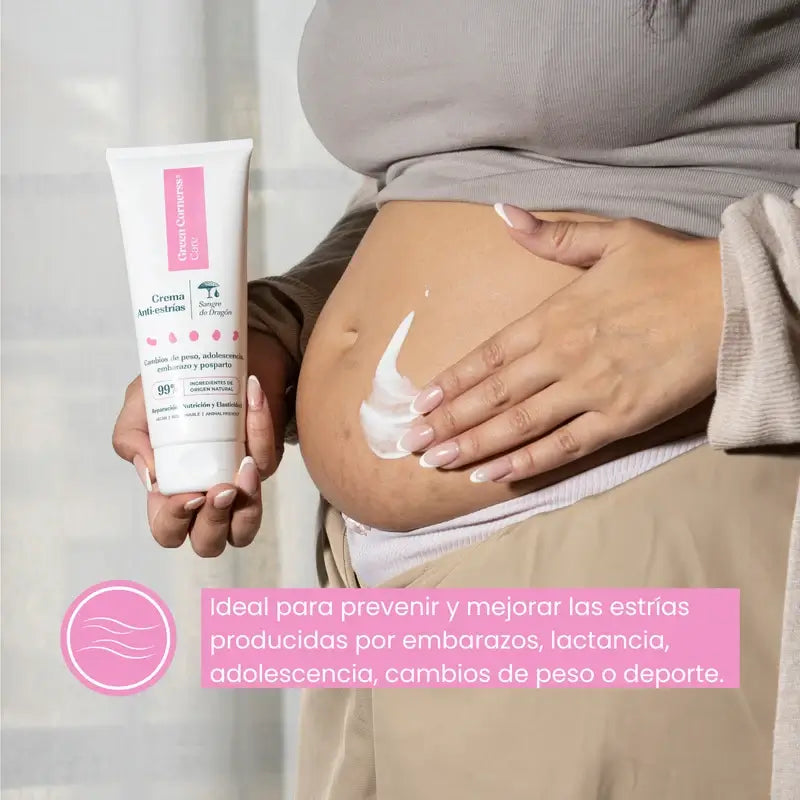 Green Cornerss Crème anti-vergetures au sang de dragon, 200ml