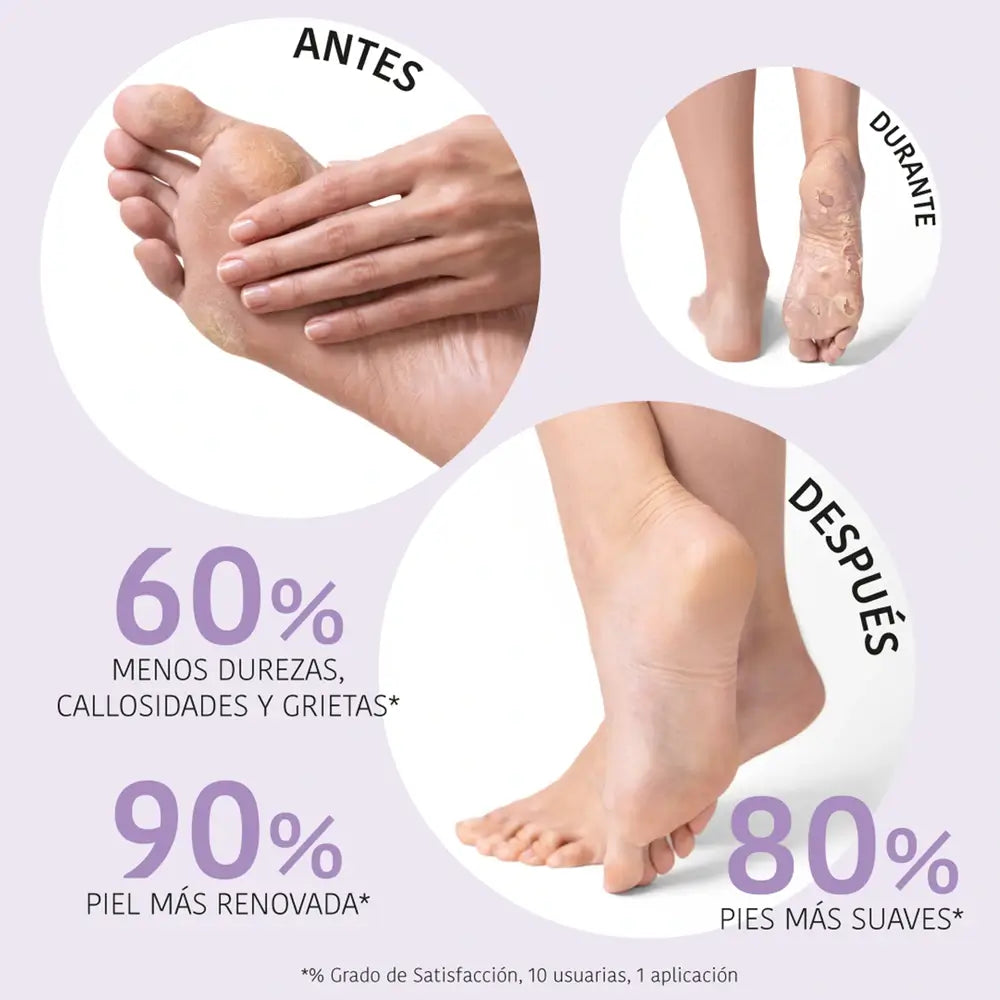 Masque gommant et exfoliant pour les chaussettes corporelles de Iroha Nature, 20 ml