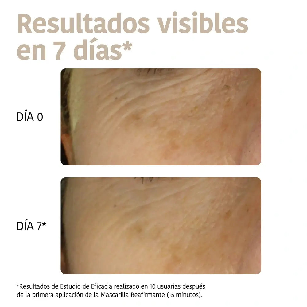 Iroha Nature Triple masque de comblement des rides à l'acide hyaluronique pour le visage et le cou, 30 ml