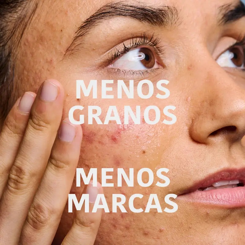 Iroha Nature Sérum anti-imperfections pour peaux grasses, 30 ml