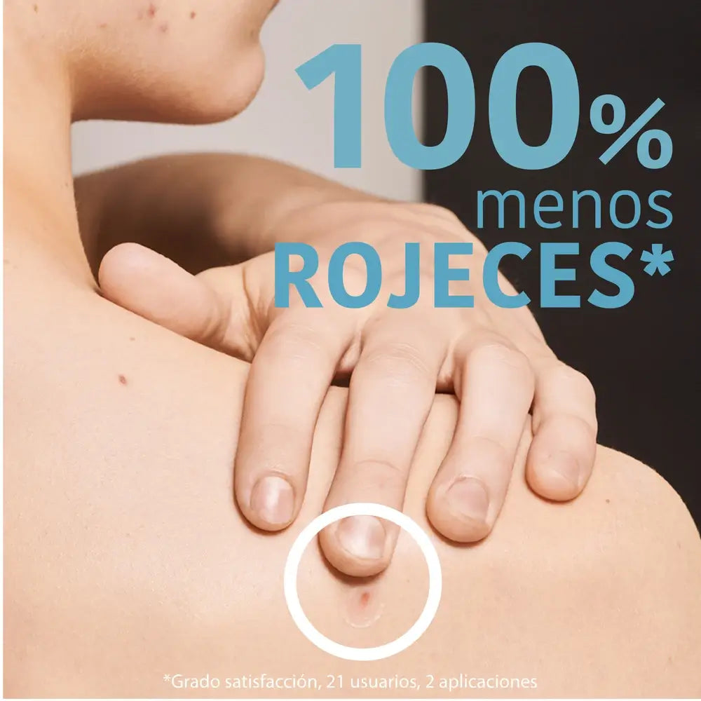 Iroha Nature Sos Pimples Patches - Acide salicylique, 18 pcs.