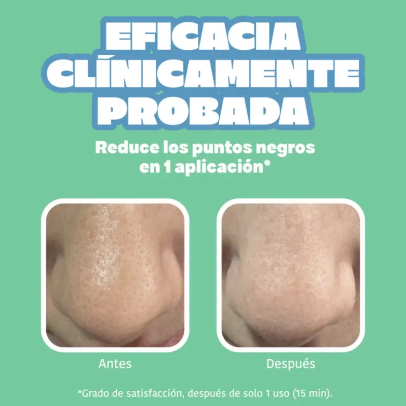 IROHA NATURE Bandelettes pour le nez BYE BYE Dirty Pores - Nettoyage en profondeur (5 pièces)