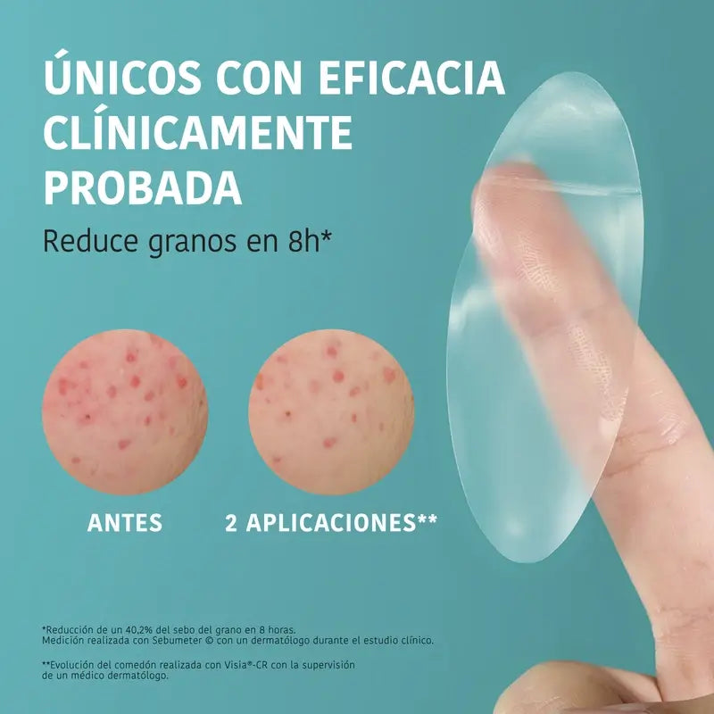 Iroha Nature Xl Patch boutons, 5 unités