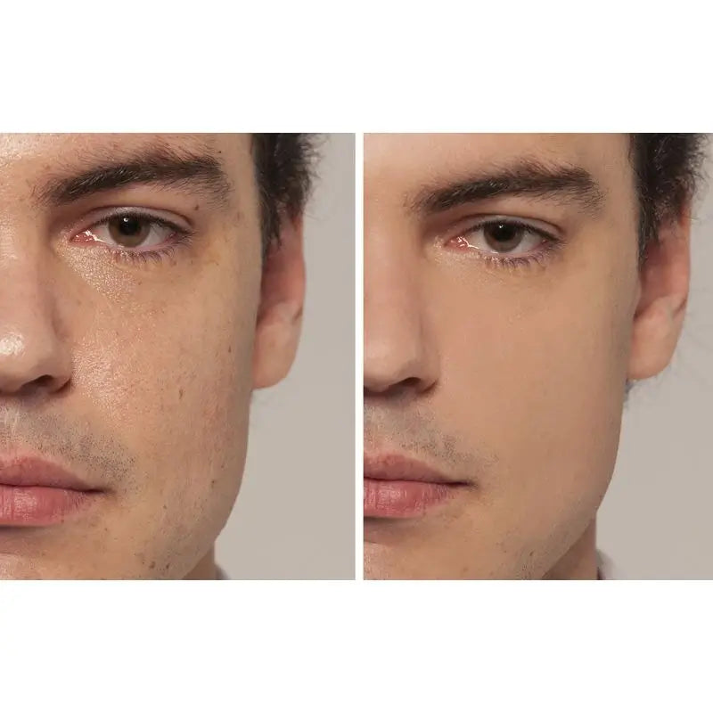 L'Oréal Paris Accord Parfait 2R Vanille Rosé Correcteur Liquide 6,8 Ml