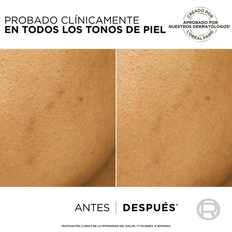 L'Oréal Paris Bright Reveal Peeling Exfoliant Anti-Blemish