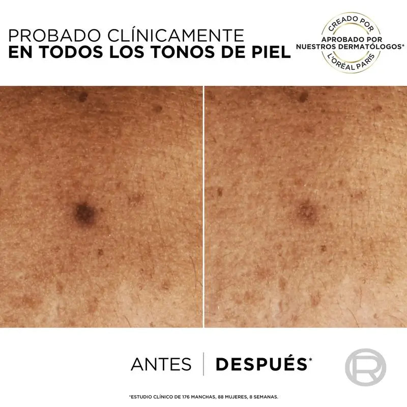 L'Oréal Paris Sérum anti-imperfections Bright Reveal Niacinamide