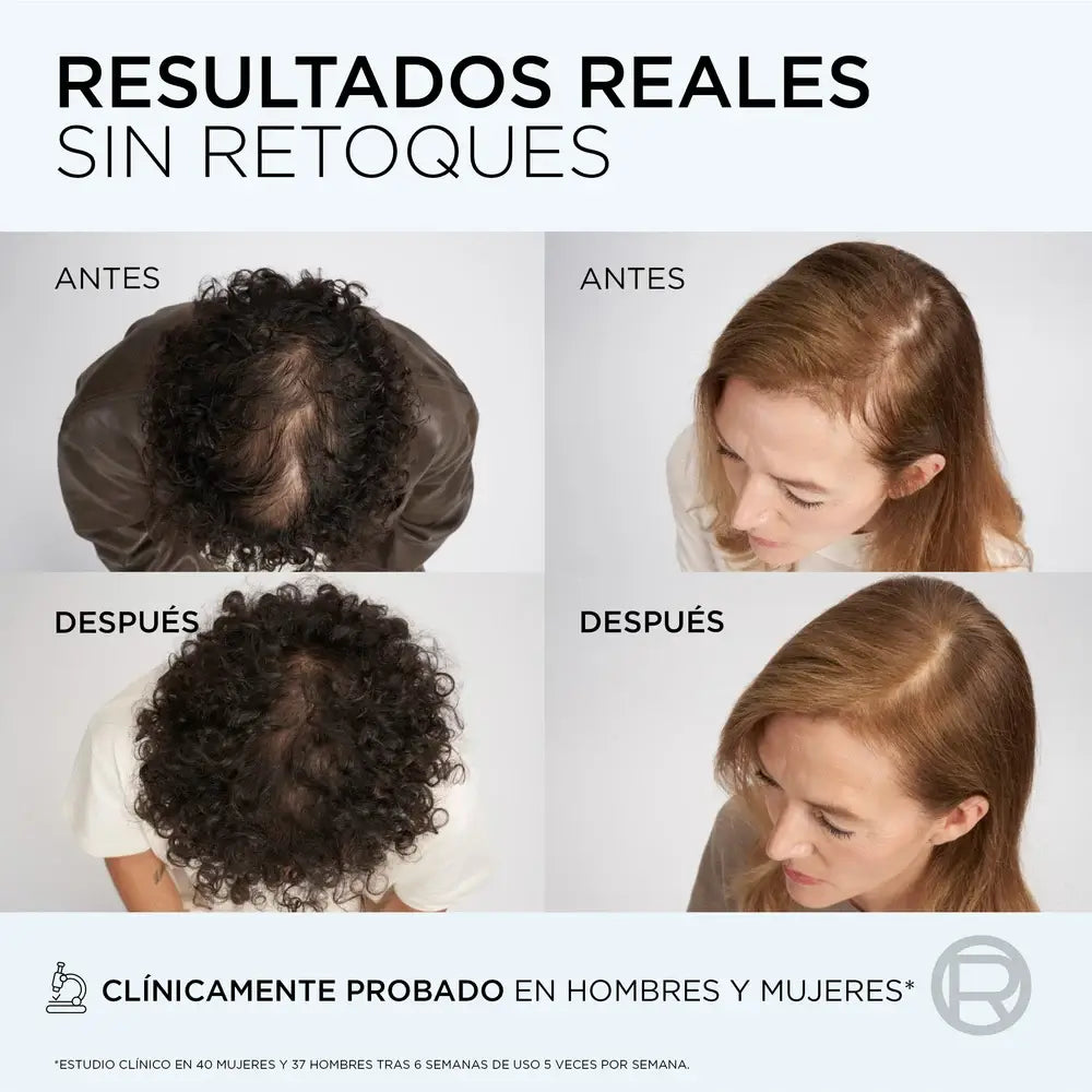 L'Oreal Paris Elvive Anti-Hair Loss Growth Booster Conditioner , 150 ml