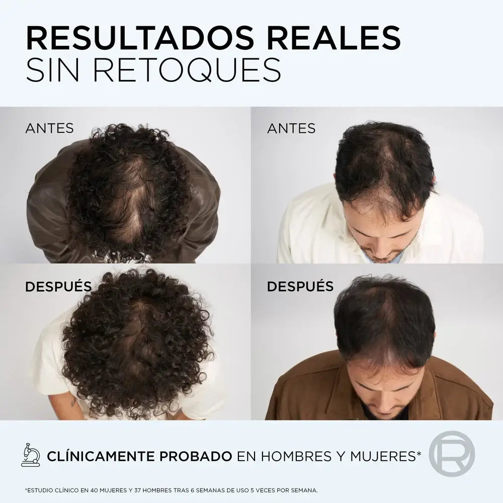 L'Oreal Paris Elvive Anti-Hair Loss Growth Booster Serum , 102 ml