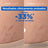 Mixa Huile anti-vergetures, 100 ml