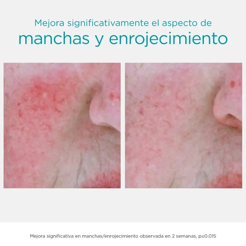 Neostrata Restore Anti-Age Facial Serum Anti-darkness and anti-spot, 29 g