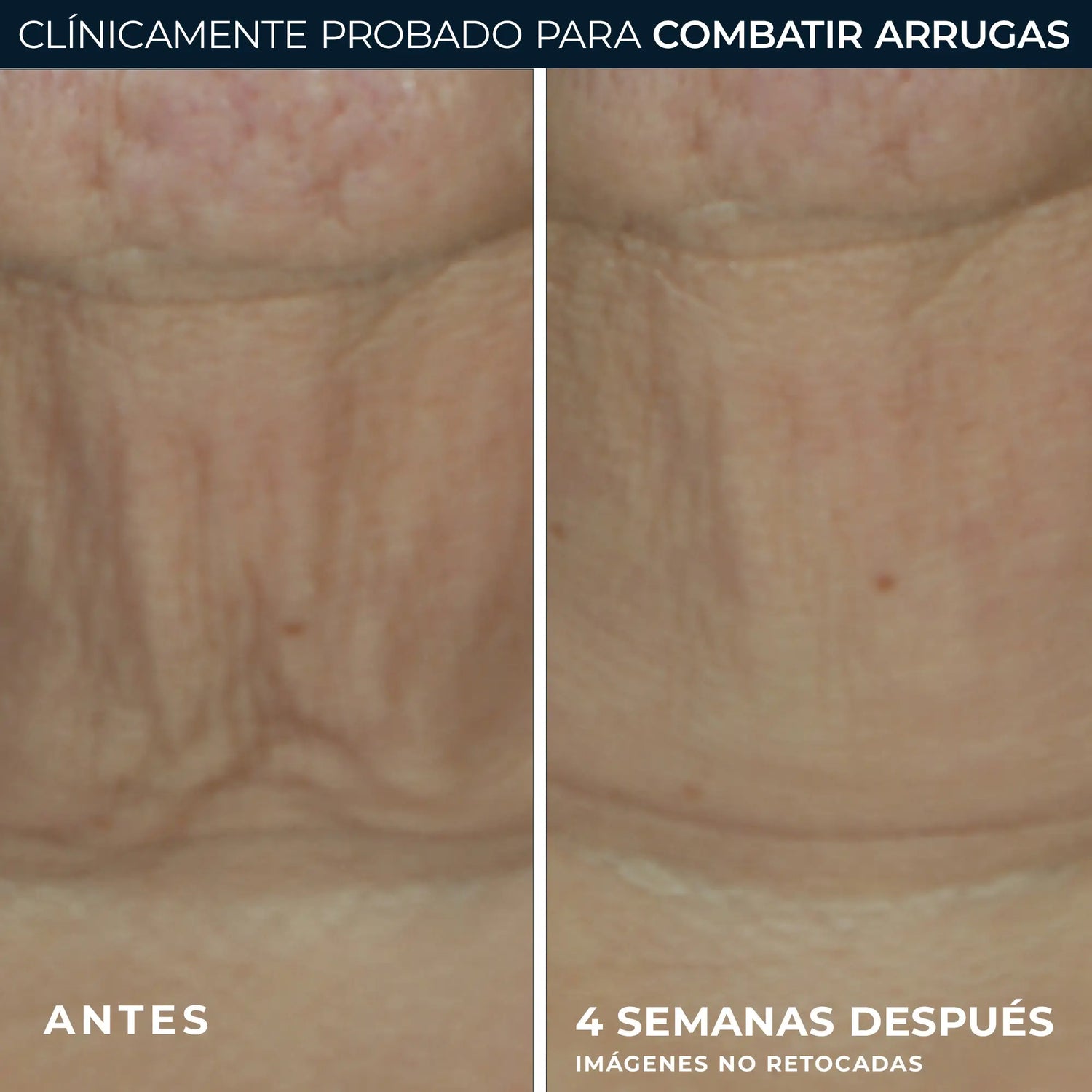 Roc Skincare Iberia Roc® Derm Correxion® Firming Stick 30G