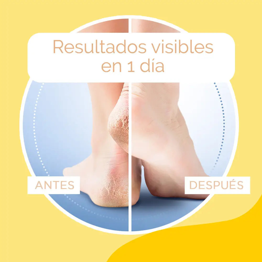 Crème pour talons crevassés Scholl K+