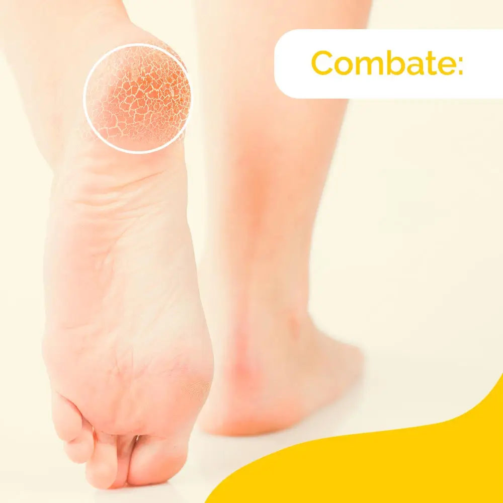 Crème pour talons crevassés Scholl K+