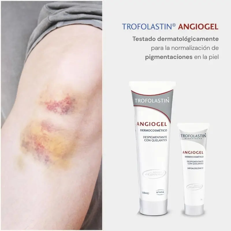 Trofolastin Angiogel Crème dépigmentante, 2x100 ml