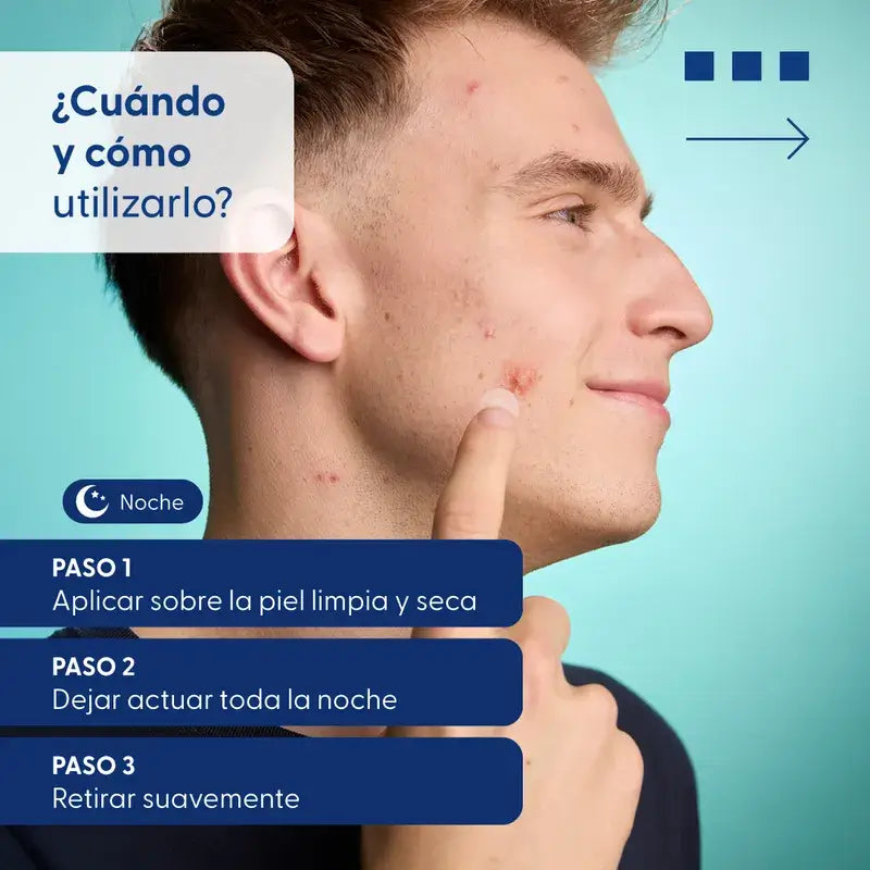 Urgo Spots Hydrocolloid Patches Micro Needling, 9 unités